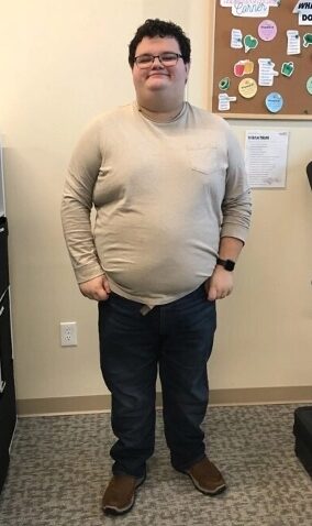 Before Weight Loss Image