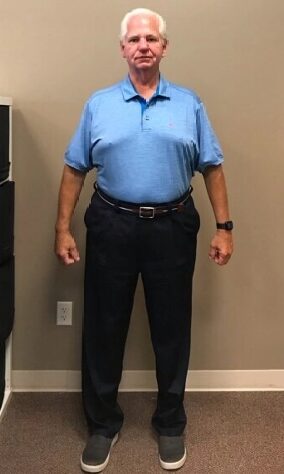 After Weight Loss Image