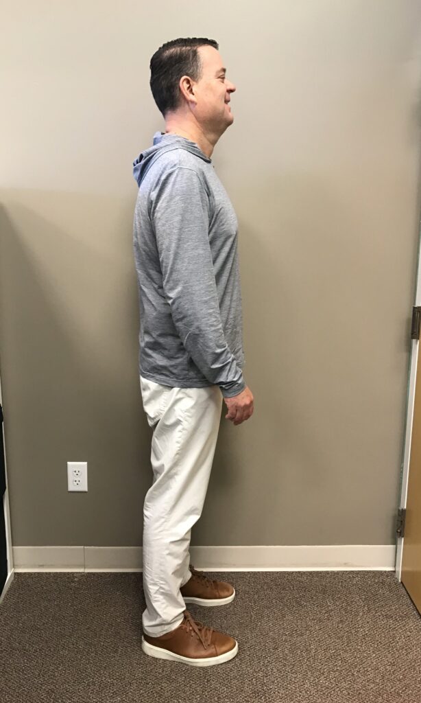 After Weight Loss Image