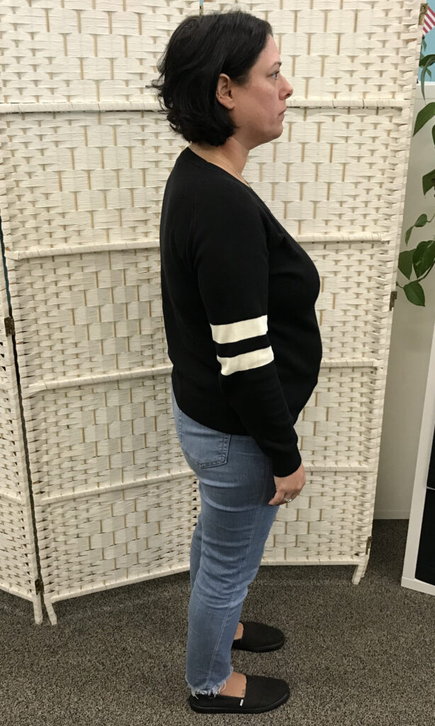 Before Weight Loss Image
