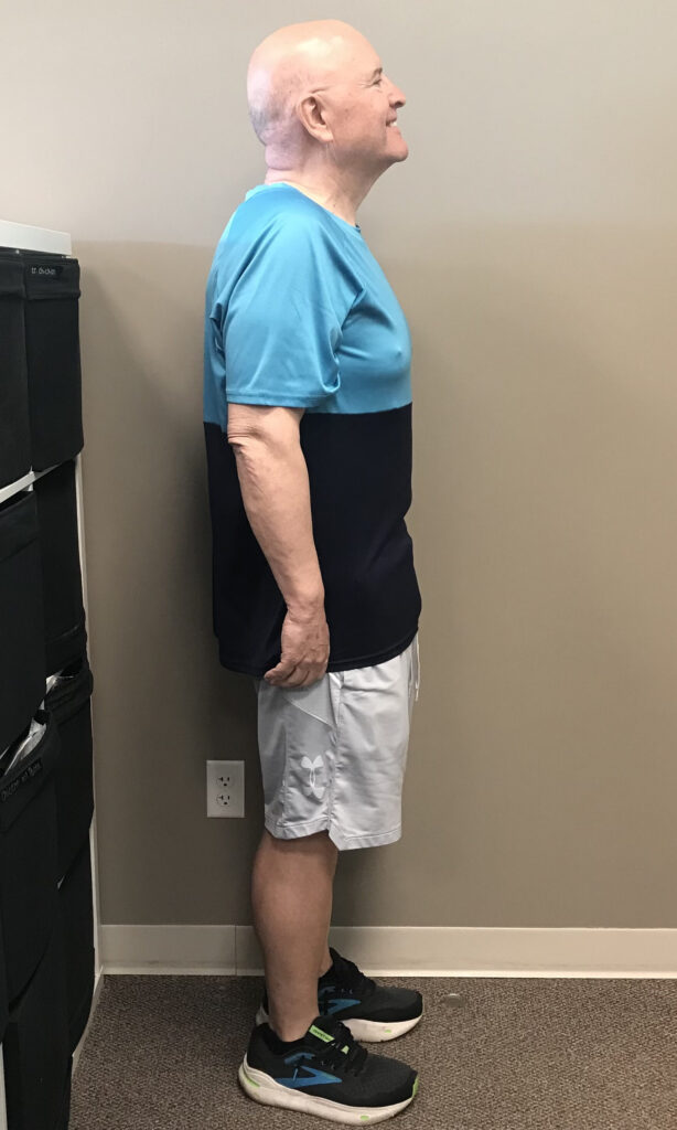 After Weight Loss Image