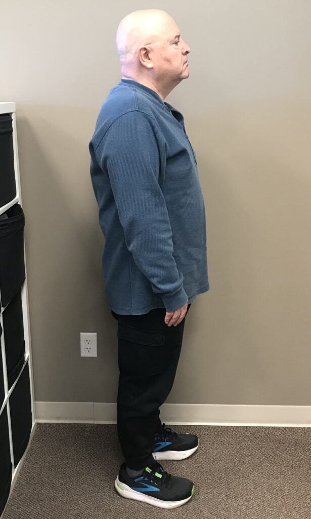 Before Weight Loss Image