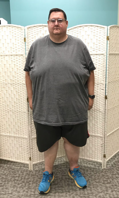 Before Weight Loss Image