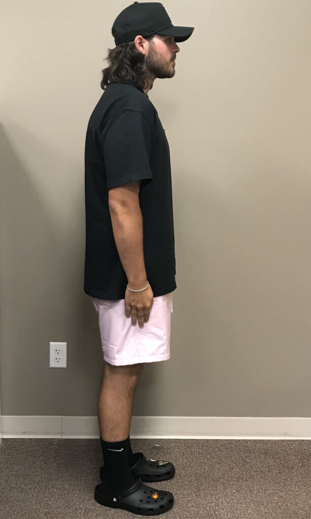 After Weight Loss Image