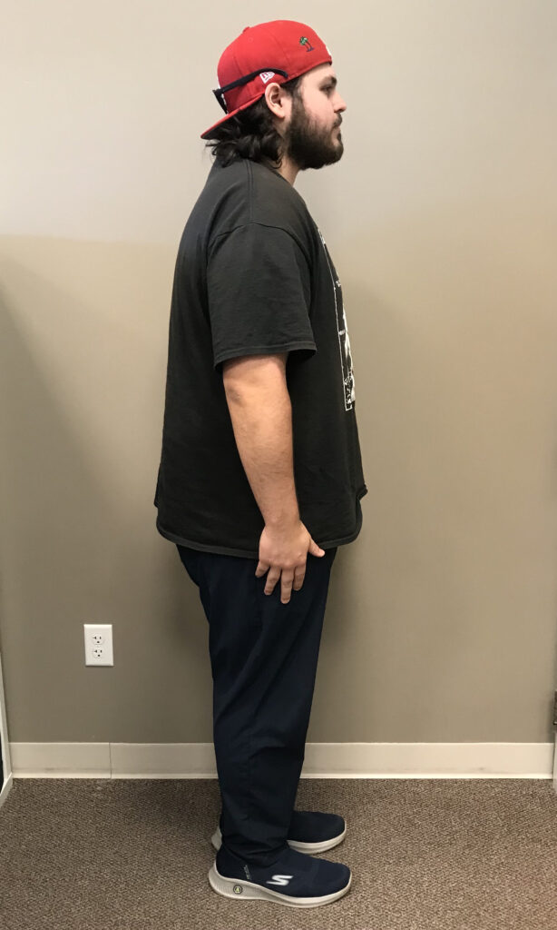 Before Weight Loss Image