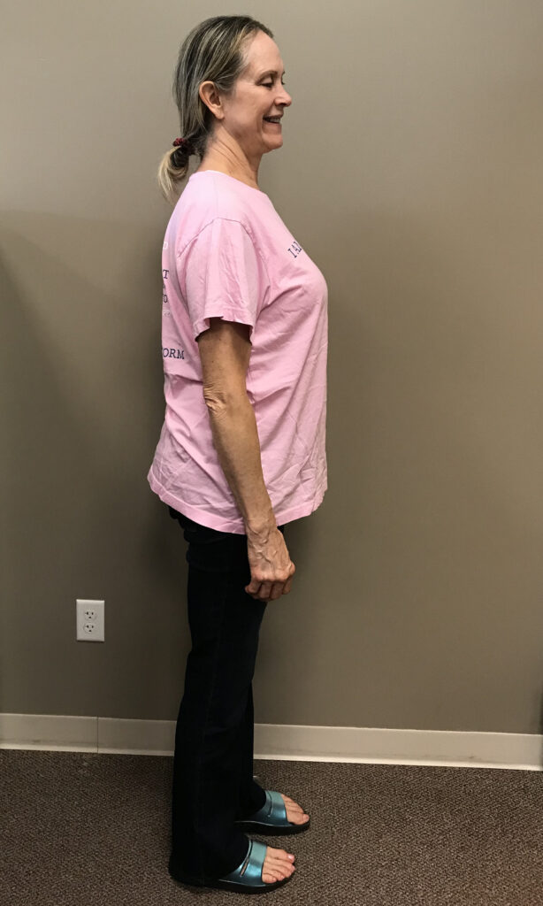Before Weight Loss Image
