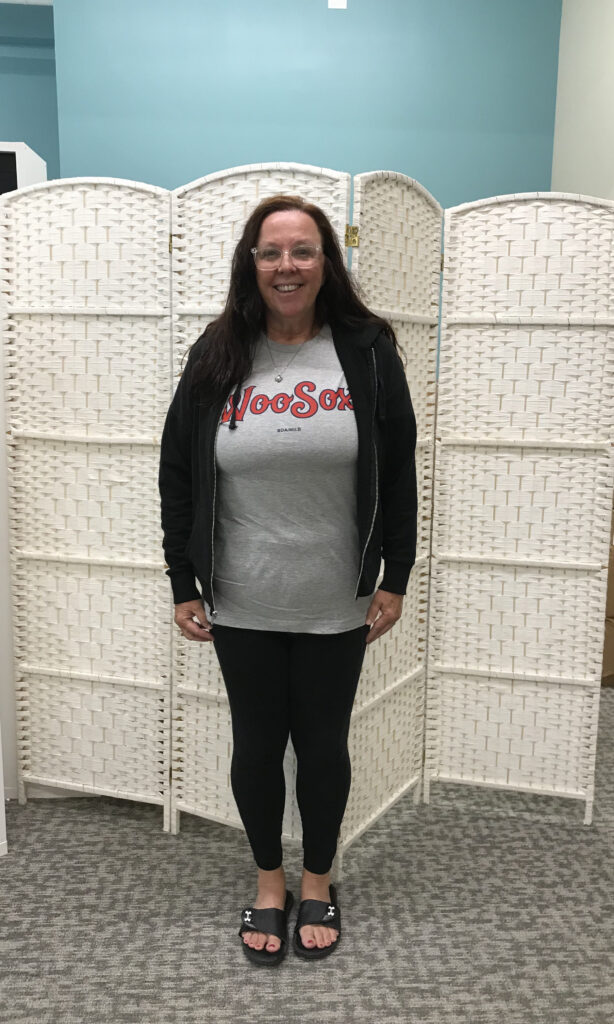 Before Weight Loss Image