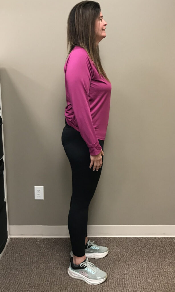 After Weight Loss Image