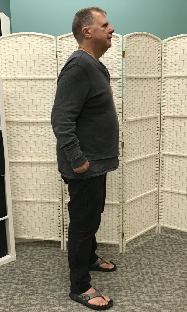 After Weight Loss Image