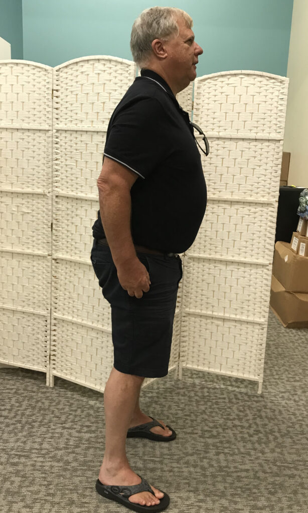 Before Weight Loss Image