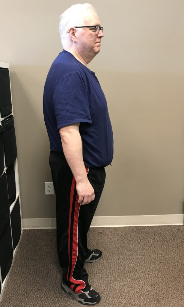 After Weight Loss Image