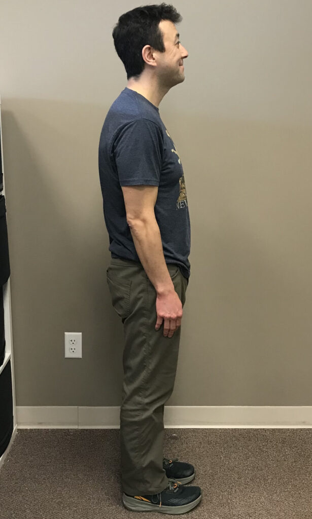 After Weight Loss Image