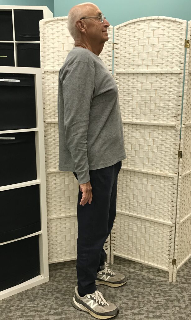 After Weight Loss Image