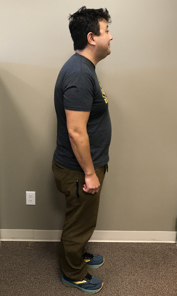 Before Weight Loss Image