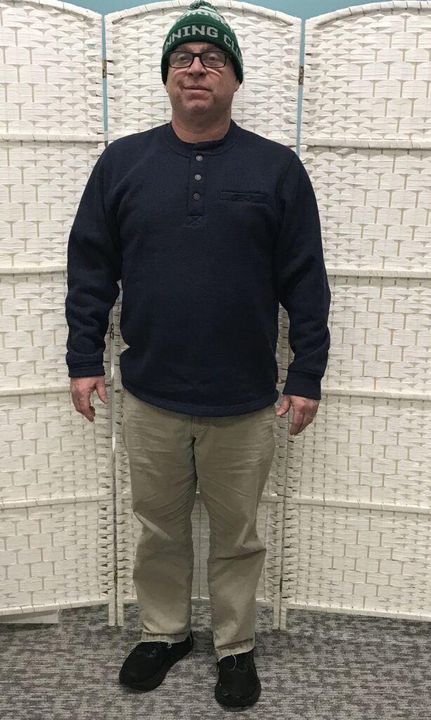 Before Weight Loss Image