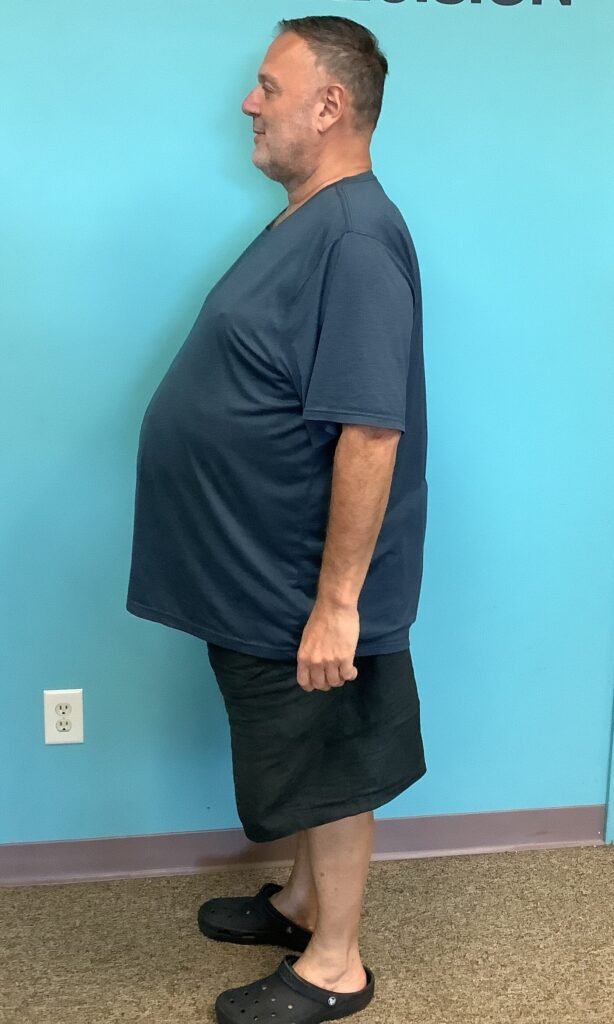 Before Weight Loss Image