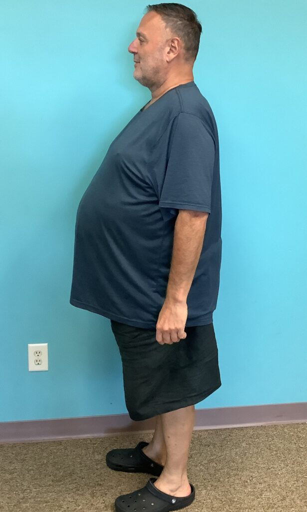 Before Weight Loss Image