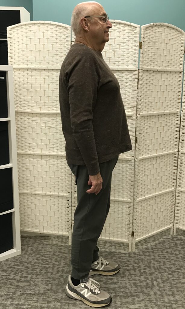 Before Weight Loss Image