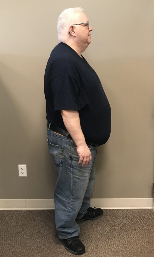 Before Weight Loss Image