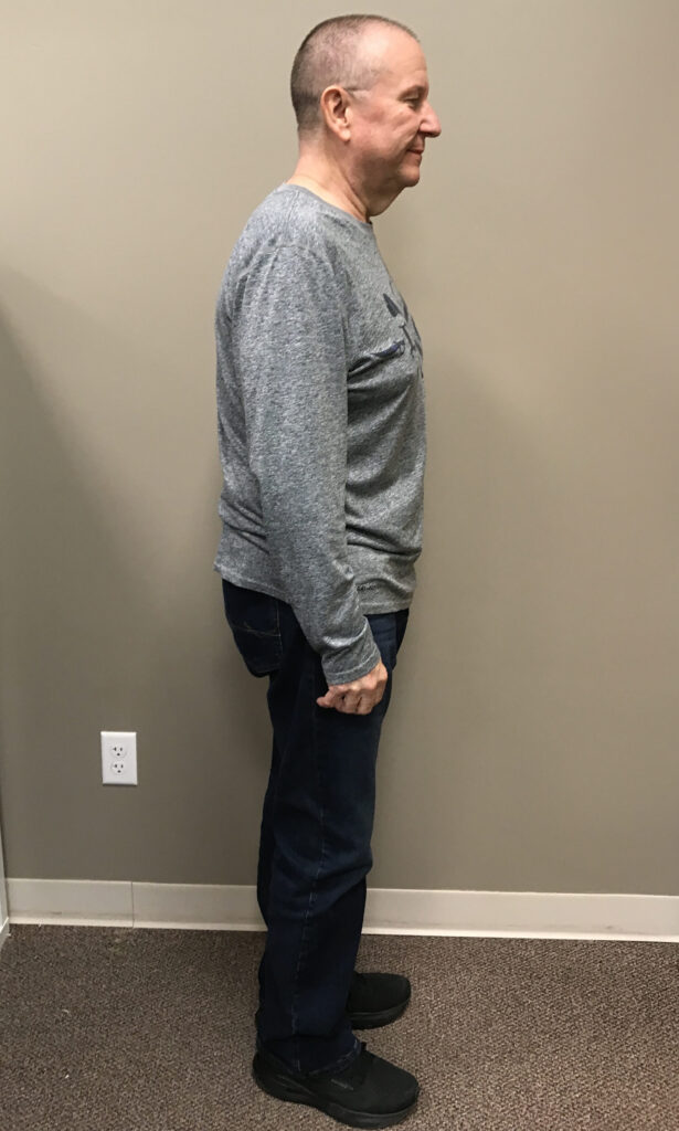 After Weight Loss Image