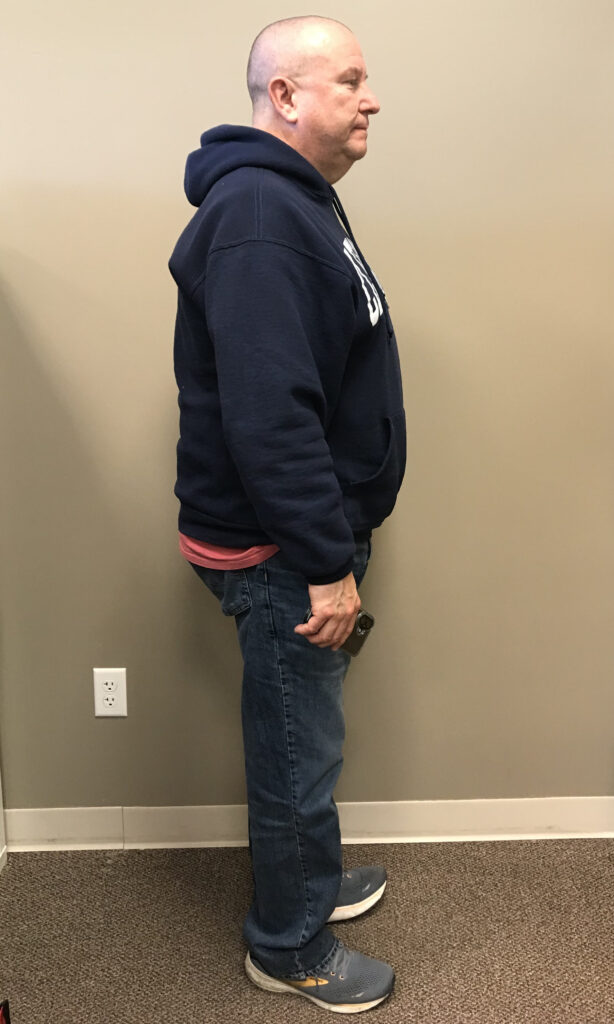 Before Weight Loss Image