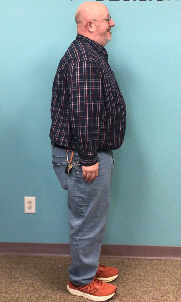 Before Weight Loss Image