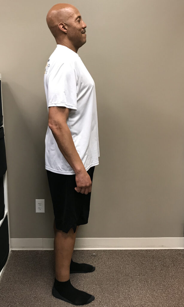 After Weight Loss Image