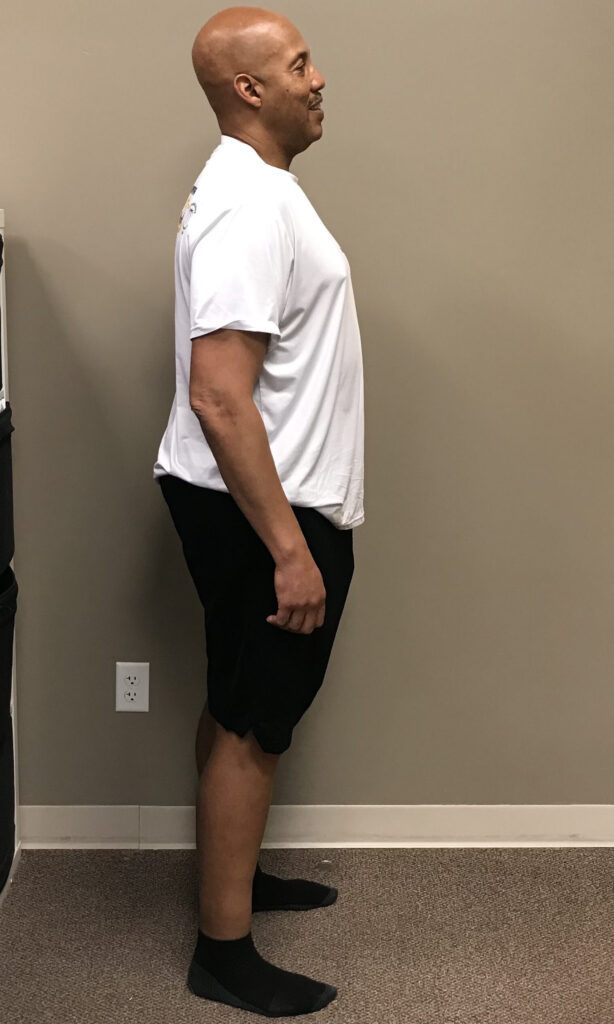 Before Weight Loss Image