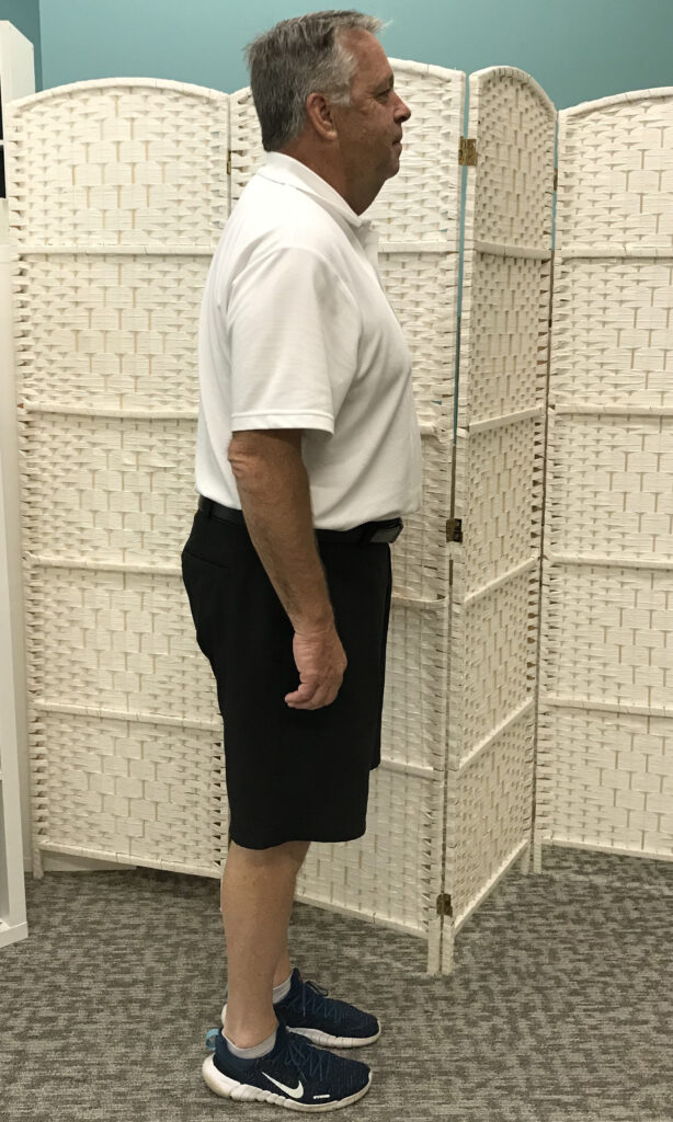 Before Weight Loss Image