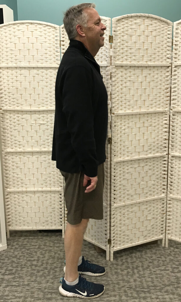 After Weight Loss Image