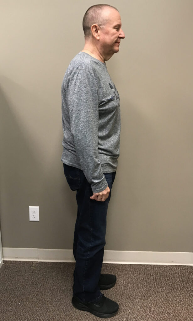 After Weight Loss Image
