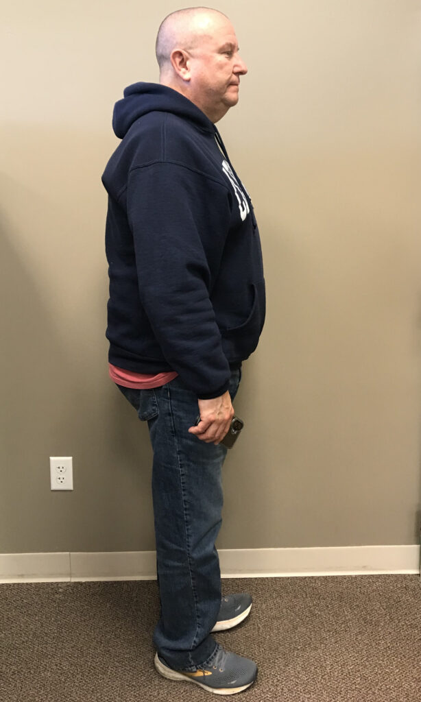 Before Weight Loss Image
