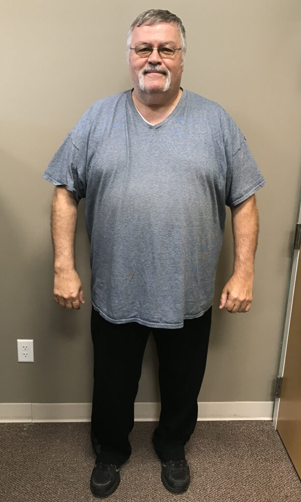 Before Weight Loss Image