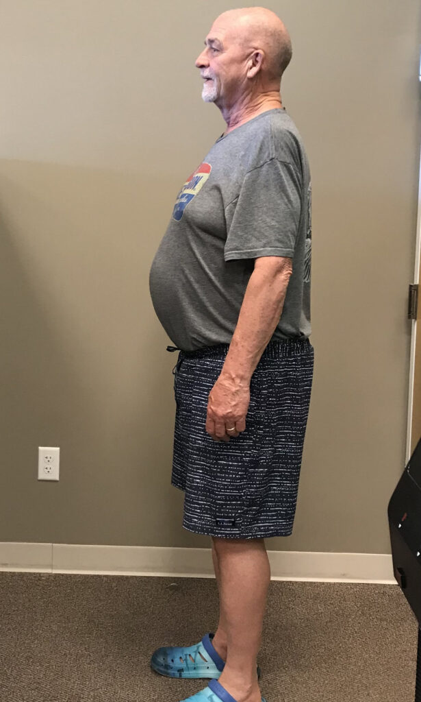 After Weight Loss Image