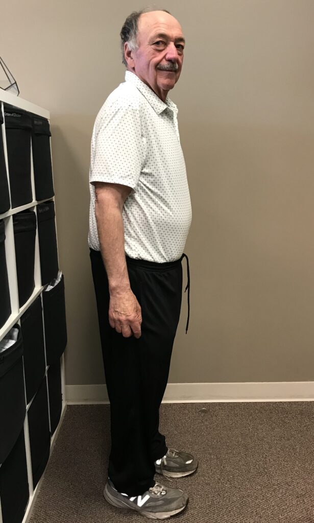 After Weight Loss Image