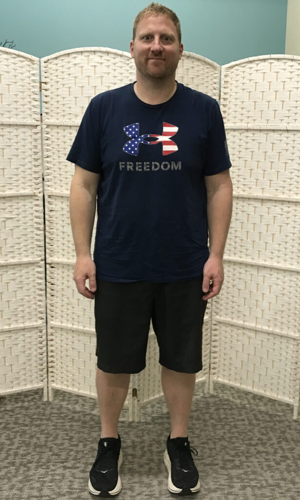 After Weight Loss Image