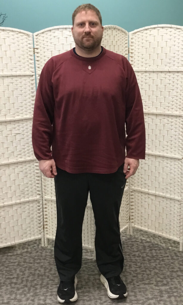 Before Weight Loss Image