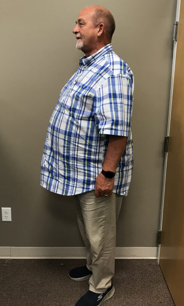 Before Weight Loss Image
