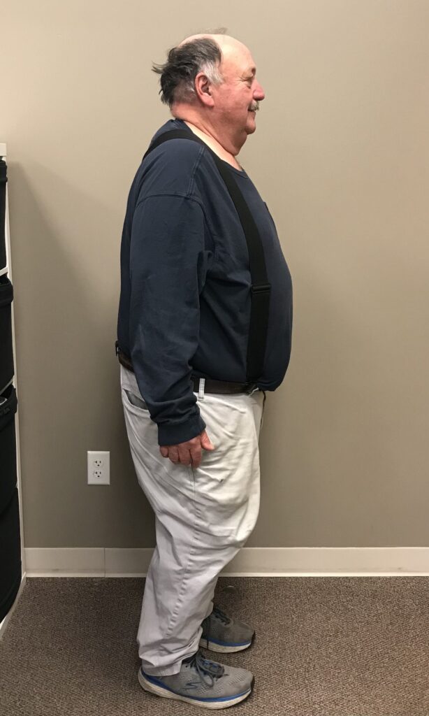 Before Weight Loss Image